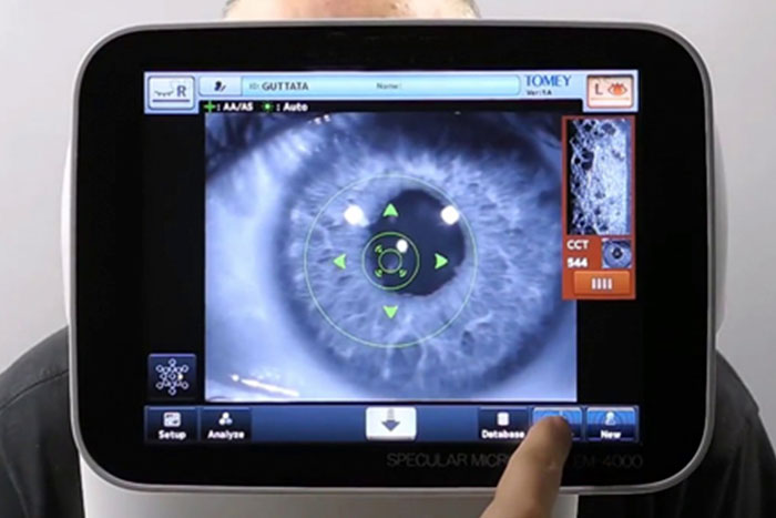 Microscopia Especular